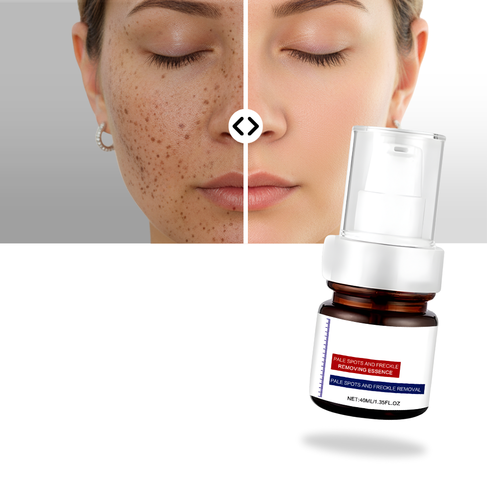 Skin Brightening Silky Kojic Serum - Ozerty