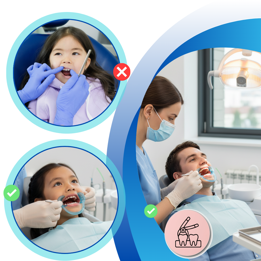 Transparent C-Shape Mouth Opener - Ozerty