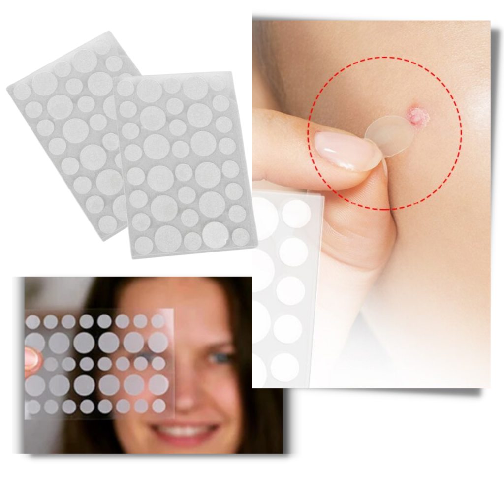 36-Pack Invisible Acne Patches