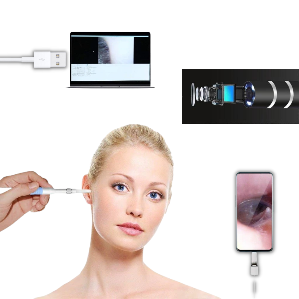 3 in 1 Ear Camera