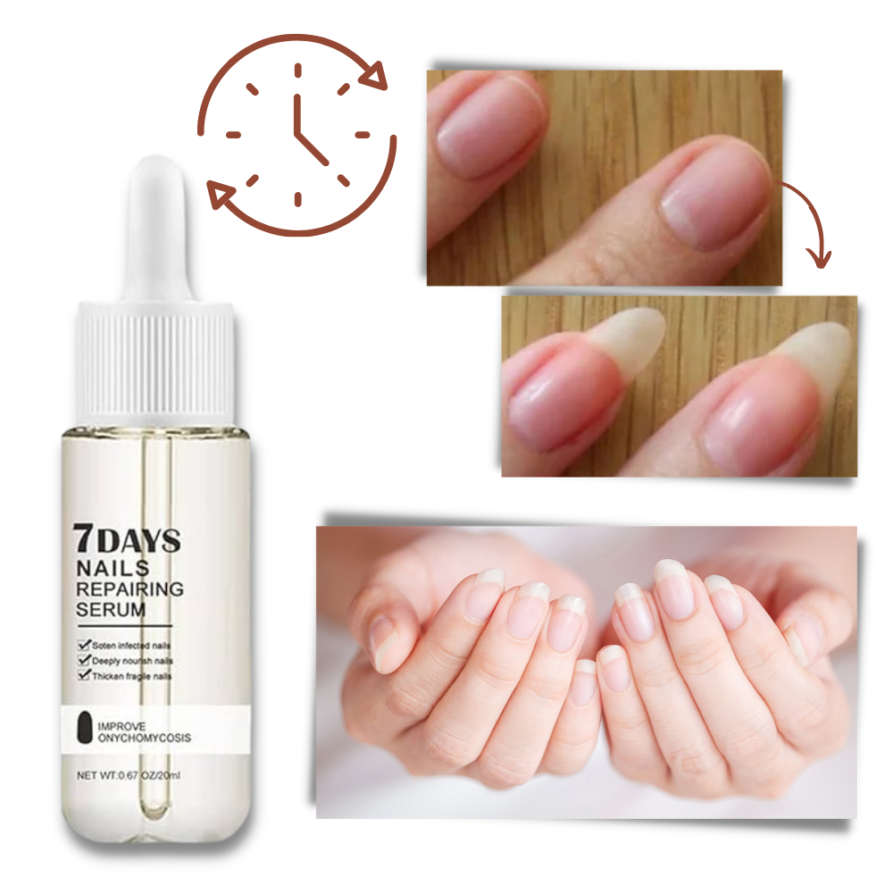 7 Days Nail Repair Essence - Ozerty