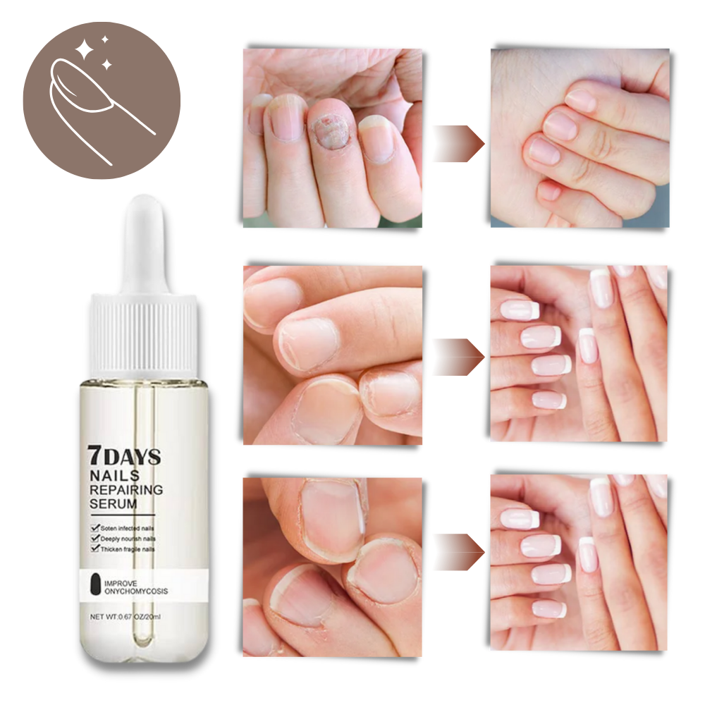 7 Days Nail Repair Essence - Ozerty