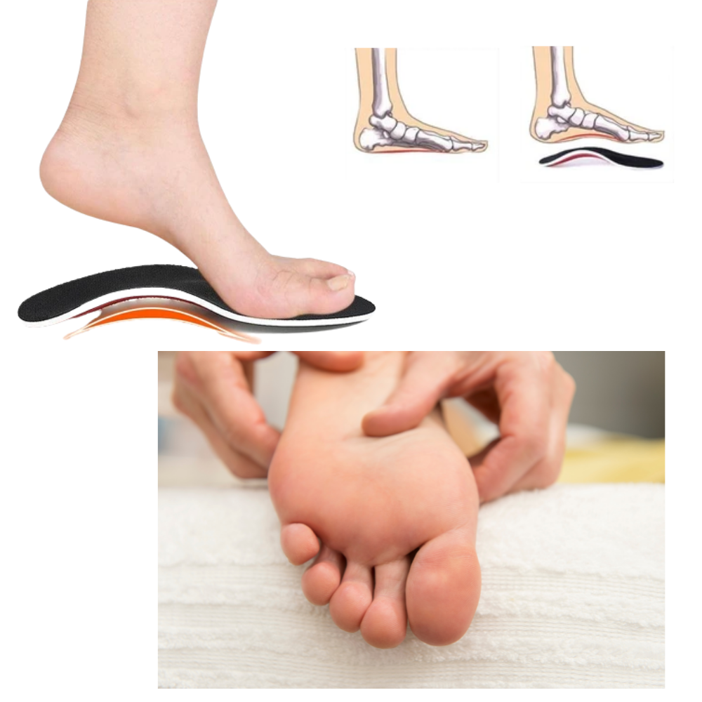 1 Pair of Arch Support Insoles for Flat Feet