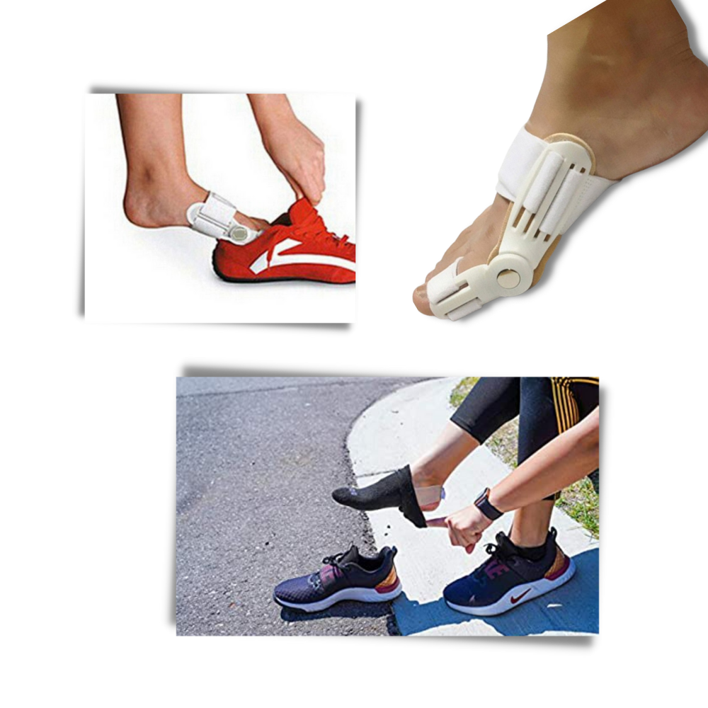 Orthopaedic Bunion Corrector