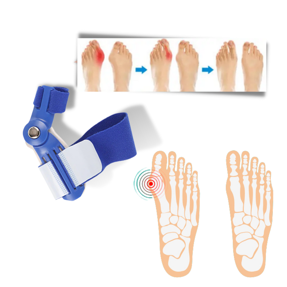 Orthopaedic Bunion Corrector