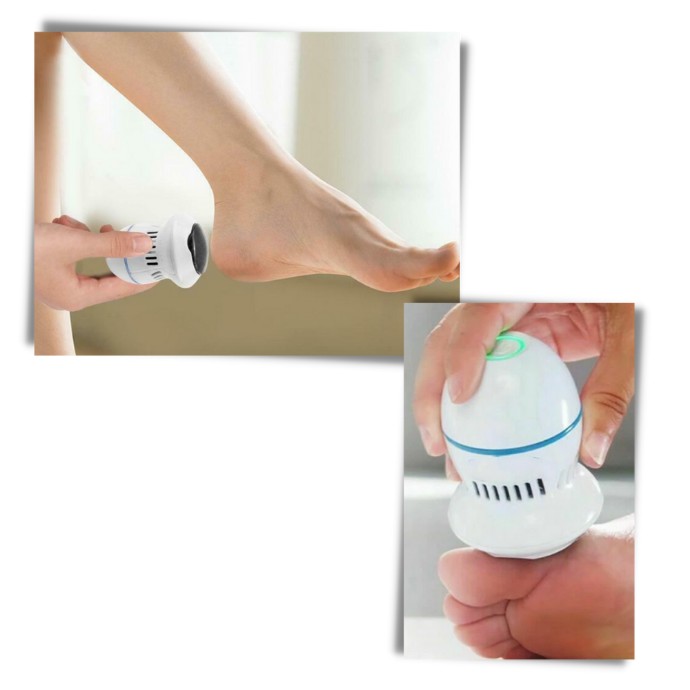 Electric Callus Remover