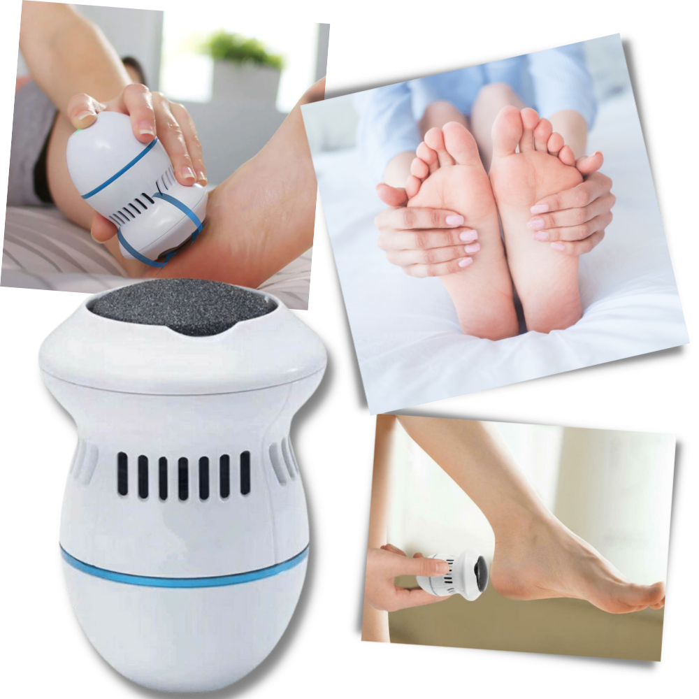 Electric Callus Remover -