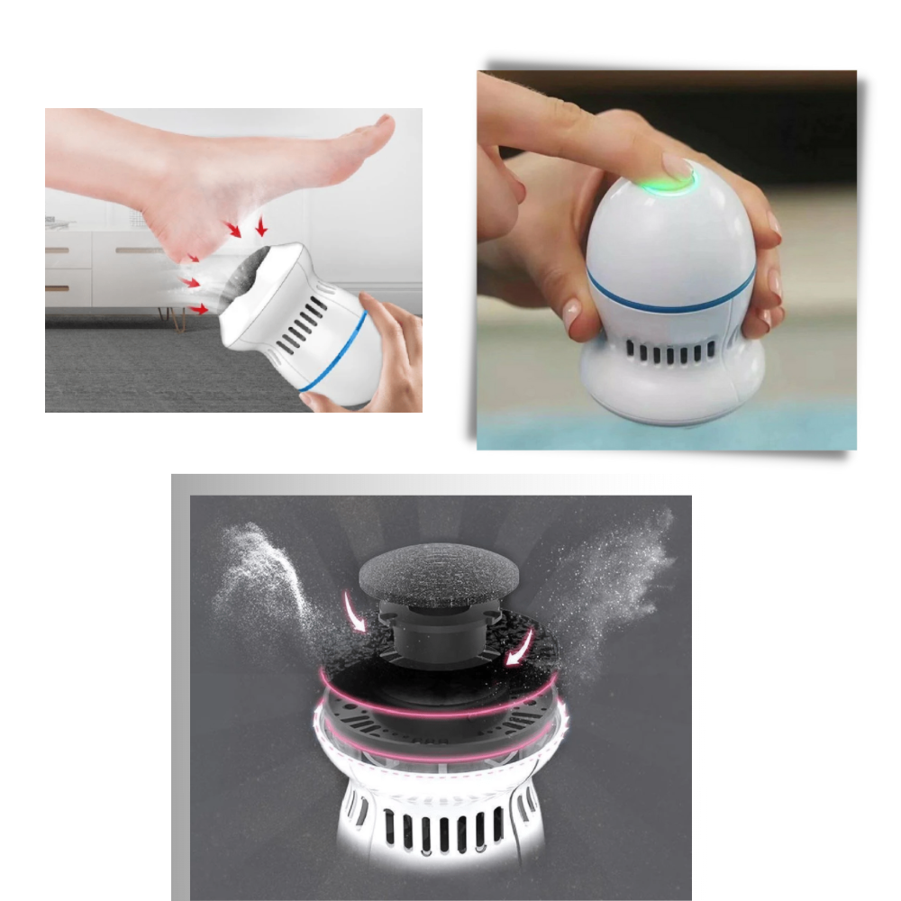 Electric Callus Remover