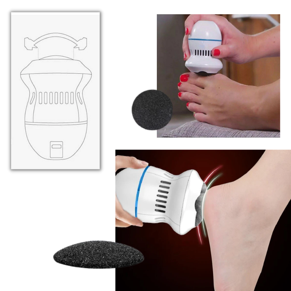 Electric Callus Remover