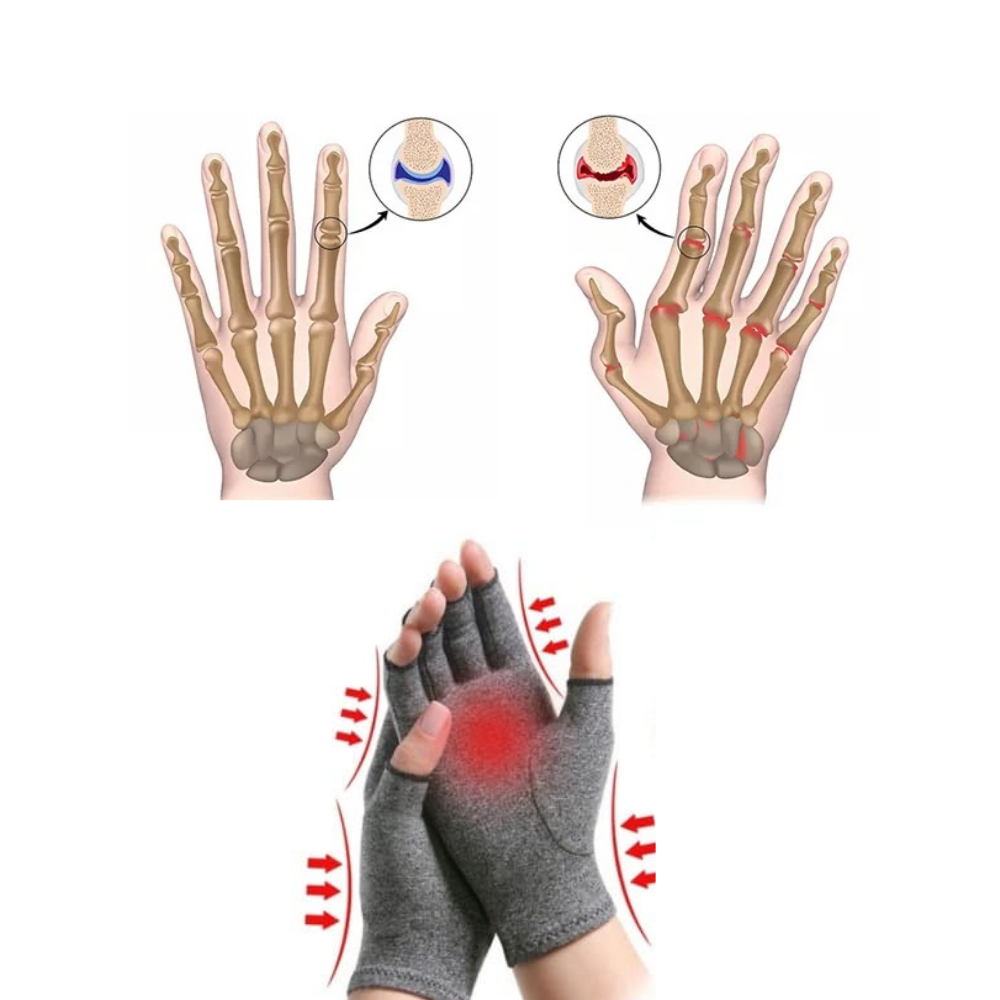 Compression joint pain relief gloves