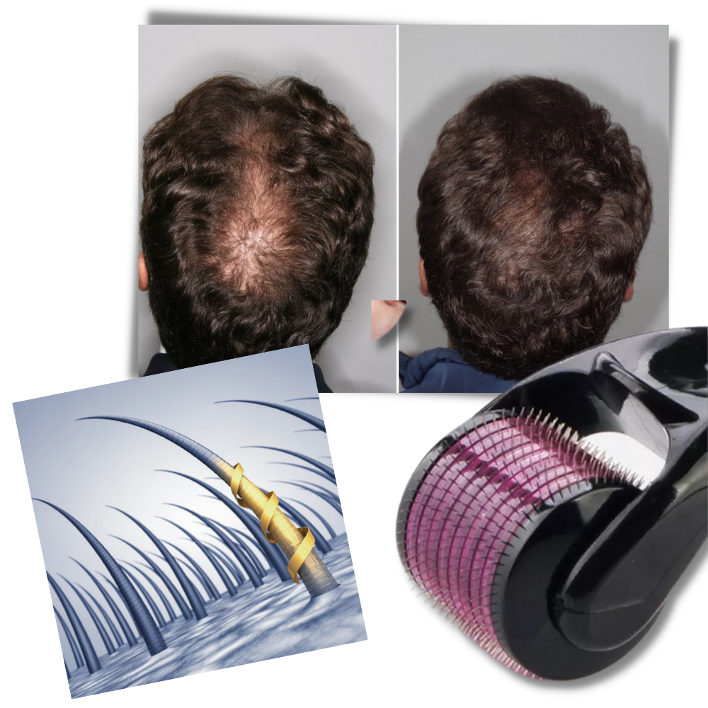 Derma roller for hair and beard growth