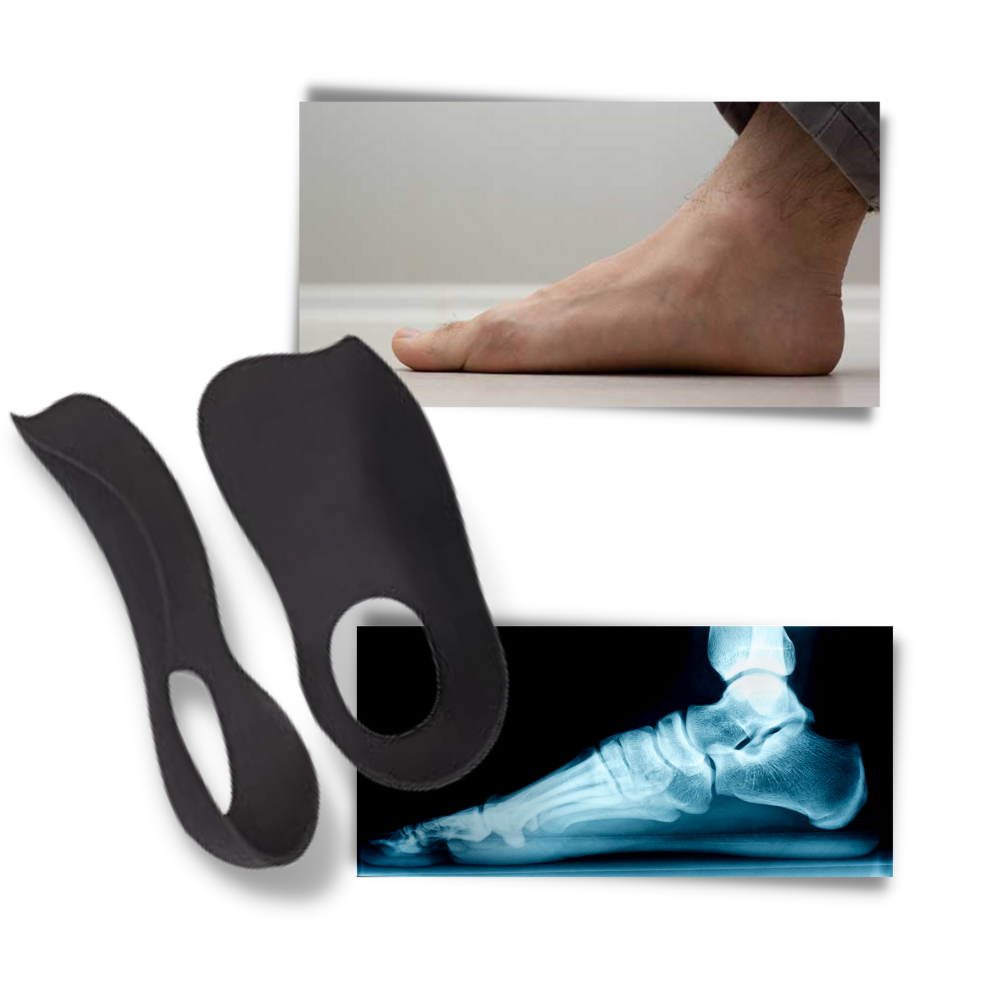 Orthopedic insoles for flat feet