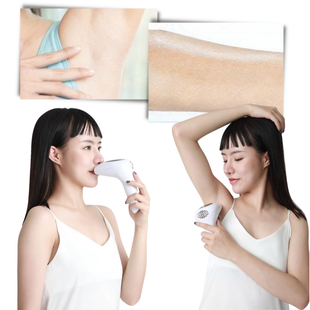 IPL Laser Hair Remover Handset