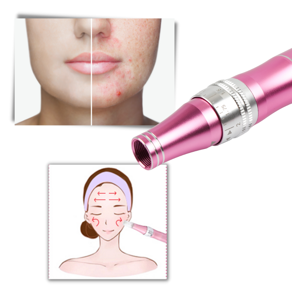 Dermal Microneedling Pen