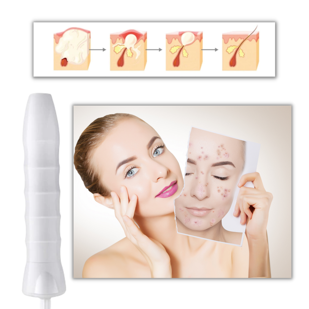 Anti-ageing skin light therapy device