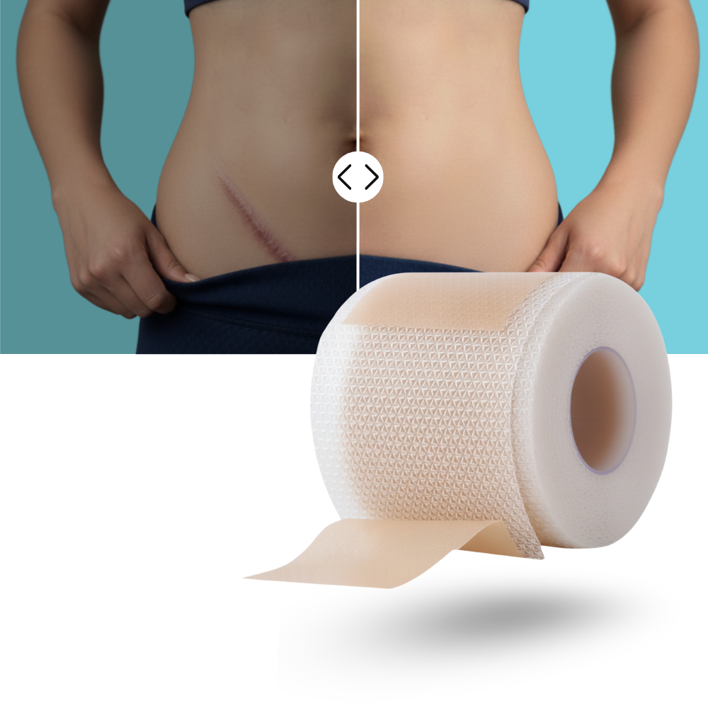 Hyaluronic Silicone Scar Patch