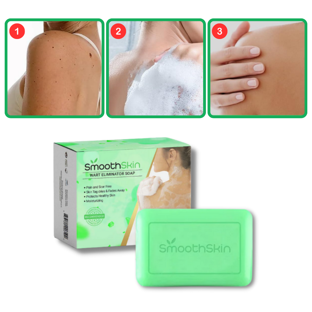 Moisturizing Exfoliator Wart Removal Soap - Ozerty