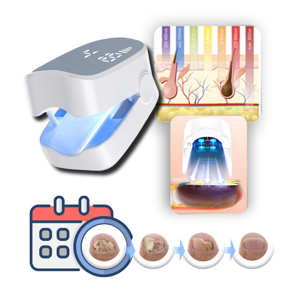 Painless Nail Fungus Laser - Ozerty