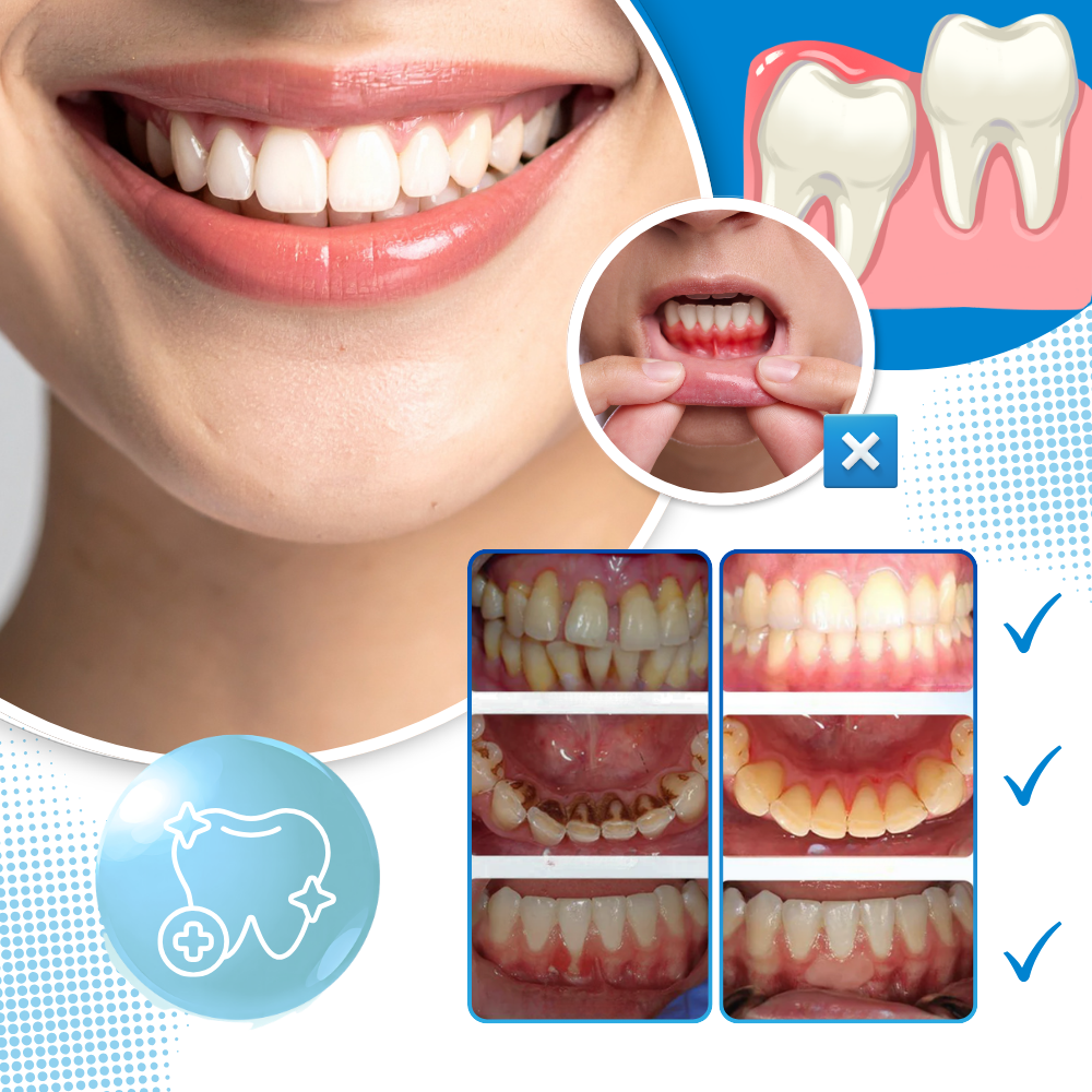 Refreshing White Dental Drops Mouthwash  - Ozerty