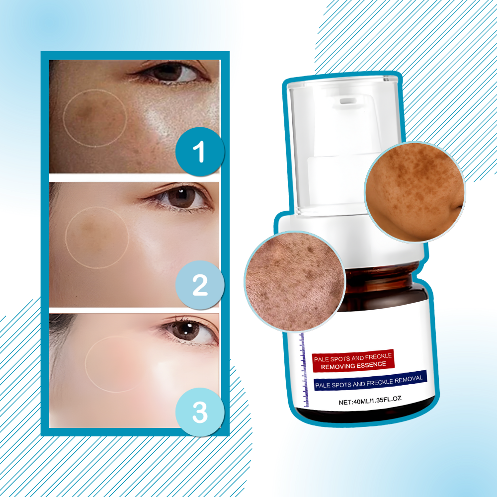 Skin Brightening Silky Kojic Serum  - Ozerty