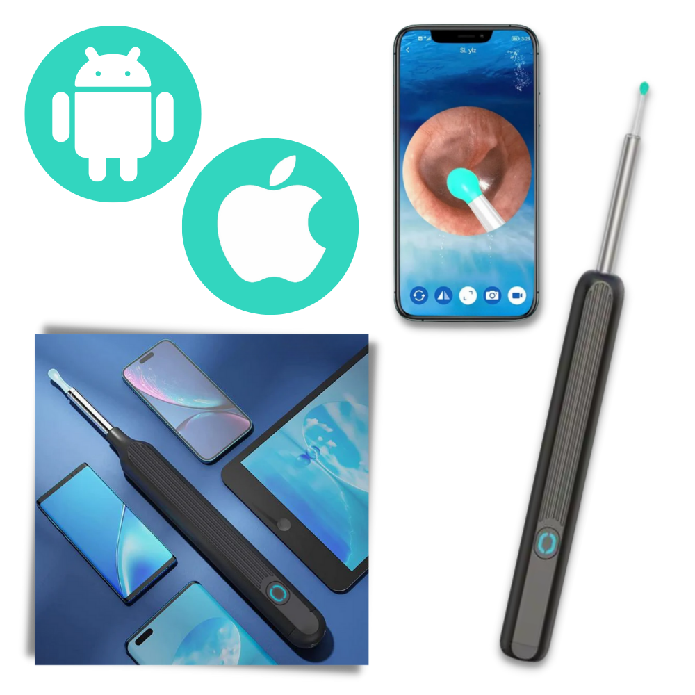 Smart Ear Wax Removal Camera - Ozerty