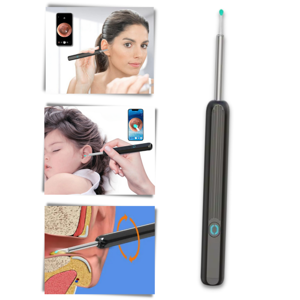 Smart Ear Wax Removal Camera - Ozerty