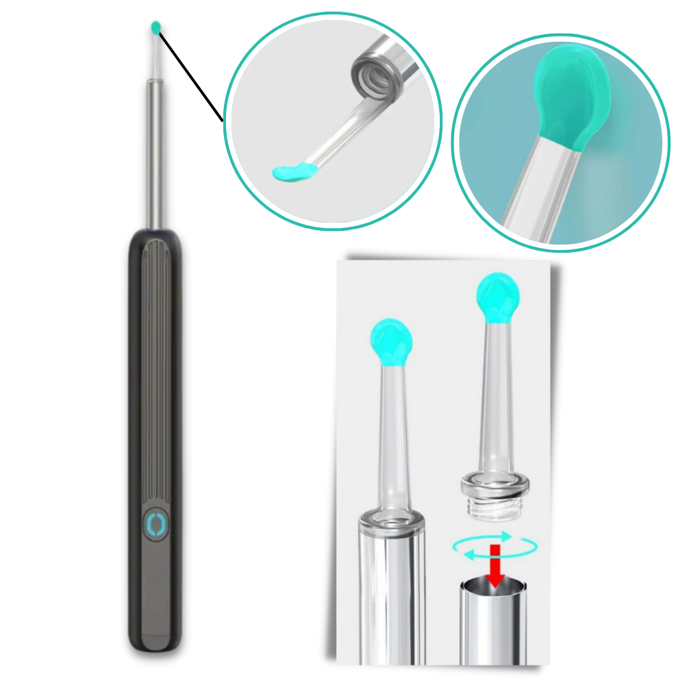 Smart Ear Wax Removal Camera - Ozerty