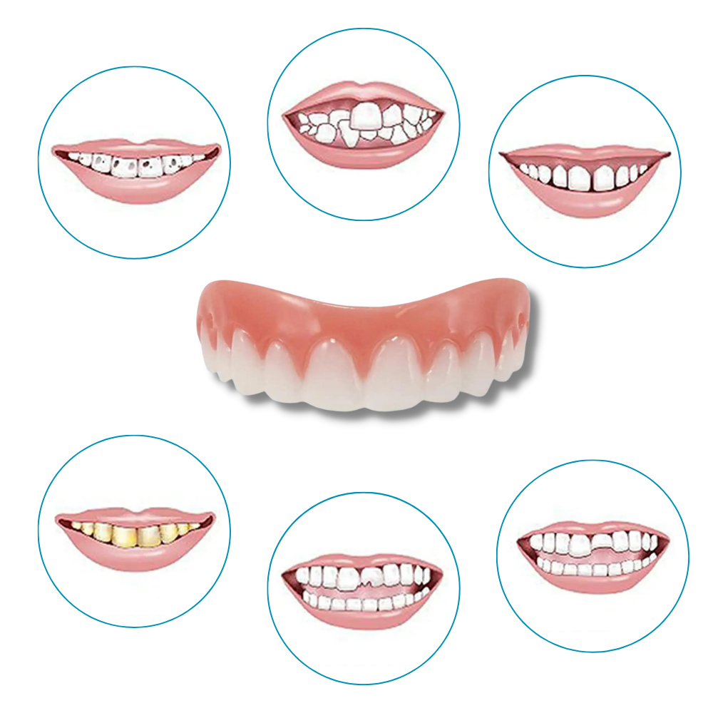 Snap-On Veneer Teeth - Ozerty