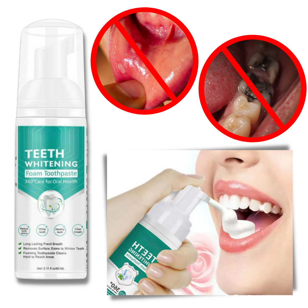 Teeth Whitening Foam - Ozerty